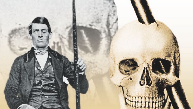 The Case of Phineas Gage and the Mysterious World of the Brain
